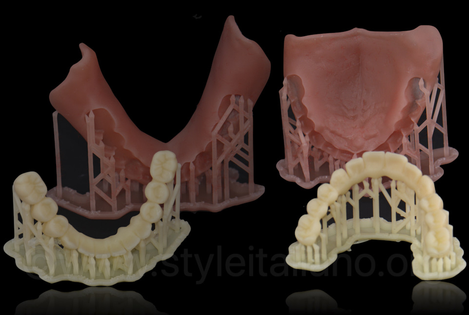 CAD CAM (3D Printed)