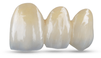 Light Cure crown